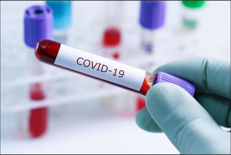 В Азербайджане зафиксировано 7 новых случаев заражения коронавирусом
