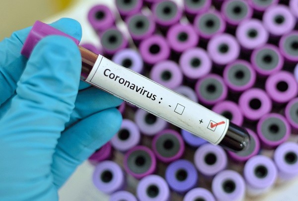 В ВОЗ опровергли данные об ослаблении коронавируса